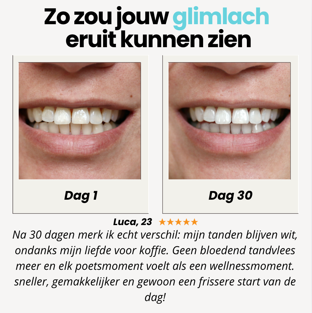 BRUSH Teeth | Stralende tanden in seconden